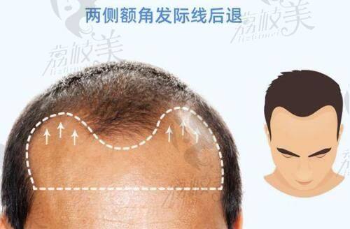 冯露葳医生擅长项目：