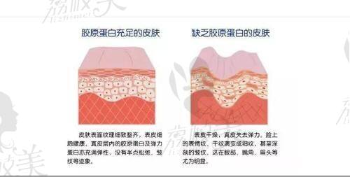 北京畫(huà)美醫(yī)療美容醫(yī)院在雙眼皮修復(fù)方面的特色優(yōu)勢(shì)