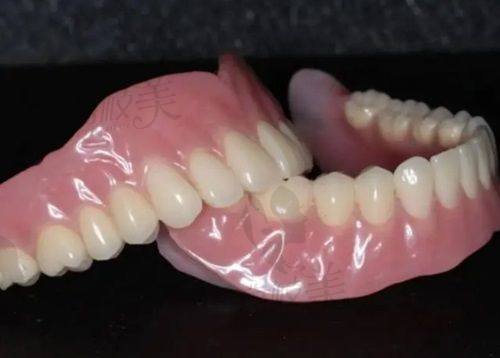 郭剑波医生的种植项目真的靠谱吗？