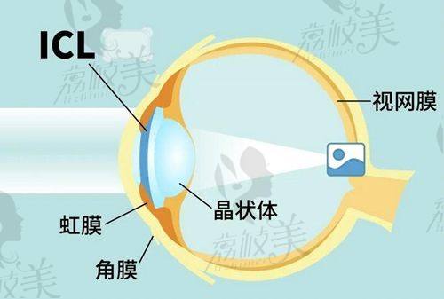 湖北爱尔眼科医院介绍，正规连锁机构医院实力没得说还有出色的口碑
