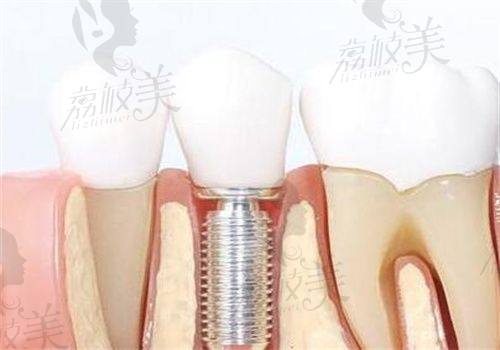 2. 东莞牙状元口腔医院有哪些科室和技术？