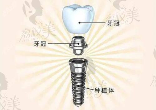 成都瑞泰口腔医院收费如何？常见项目价格大揭秘，性价比超乎想象！
