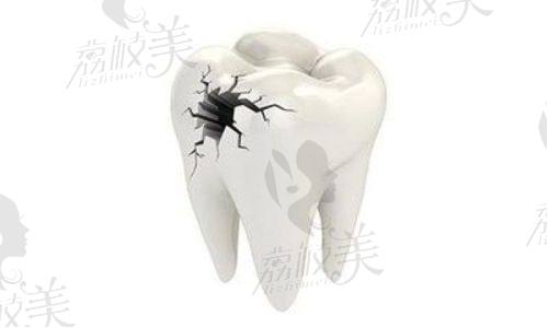五、拔牙/根管/补牙价格真面目曝光！
