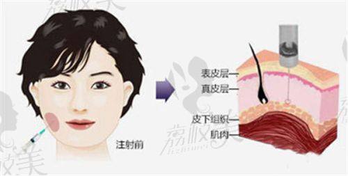 金柱翰医生技术特点: