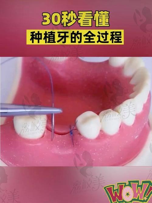 3. 东莞牙状元口腔医院的医生团队怎么样？