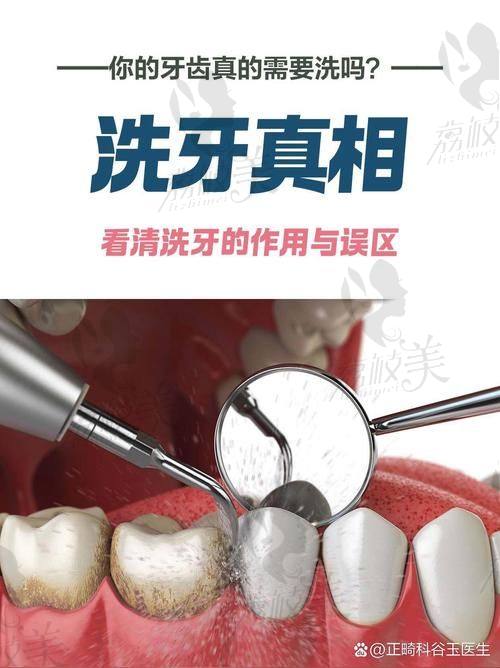 八、牙齿美白费用