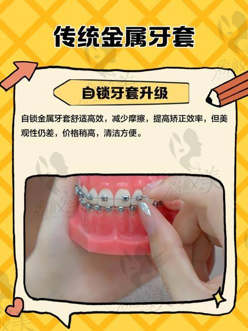 东莞牙状元口腔医院地址在哪里？雍华庭正对面，医保定点+种植牙2980元起！