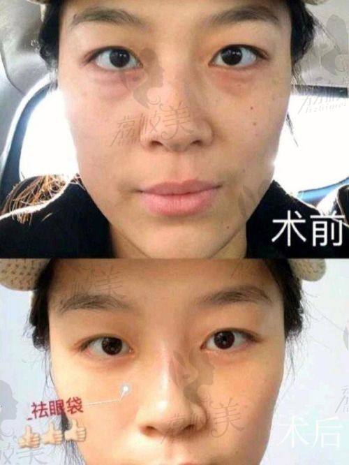 中山贝熙医疗美容医院口碑爆棚：大家都说好
