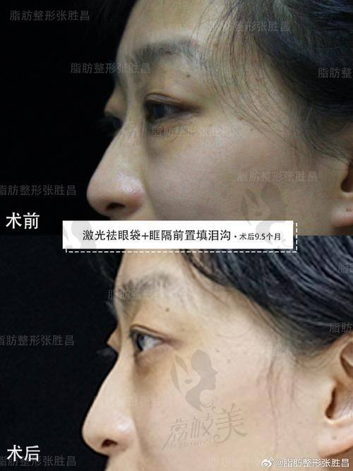 中山贝熙医疗美容医院：专精靠谱的医美殿堂