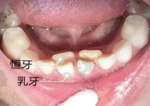 金载勋医生技术特点：