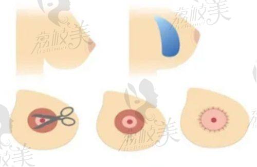 选择南宁柏琳悦美整形医院的优势