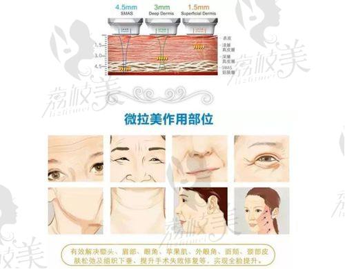15800元起鼻综合套餐亮点有哪些？