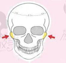 袁磊医生技术特点：