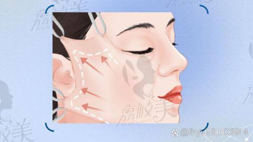 重慶鄭荃麗格注射抗衰超靠譜，多產(chǎn)品可選且價(jià)格2000元起