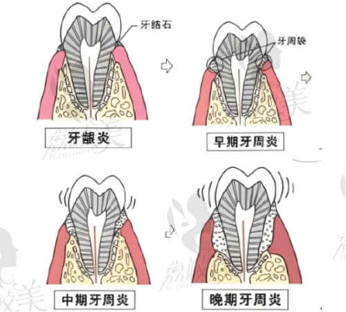 临床实例：真实成效说话
