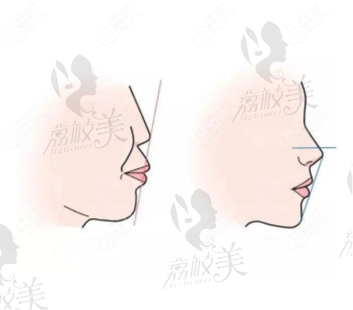 维护保养：让种植体陪你更久