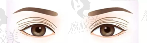 杭州市第三人民医院皮肤科怎么样？权威资质、专家团队与特色项目打造优质诊疗体验！