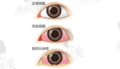 三、选择建议