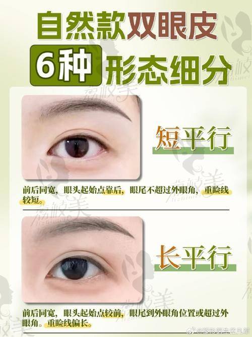 2025年杭州双眼皮修复价格总体情况