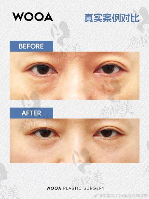 中山贝熙医院:医美界的温馨港湾