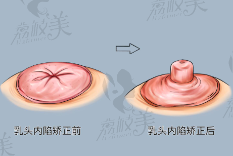 李韵芳医生技术特点：