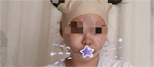 二、洛阳华美医疗美容医院科室与项目
