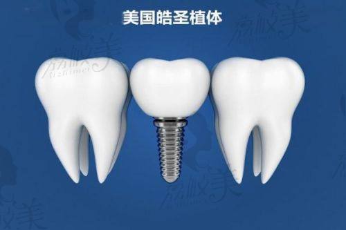 儿童窝沟封闭成功实例