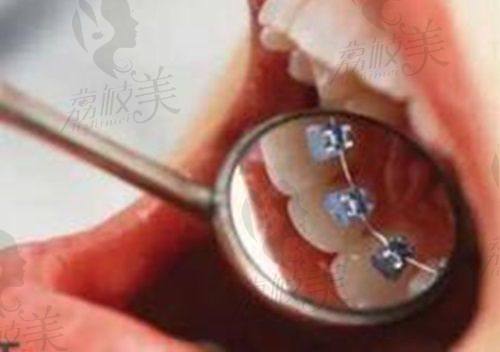 预约挂号方式：便捷多样轻松就诊