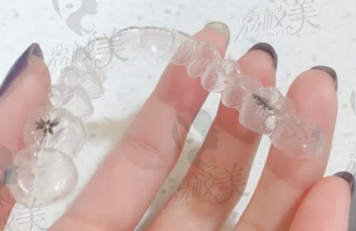 湛江市珠江口腔牙齿贴面价格1280起，轻松拥有明星般闪耀笑容
