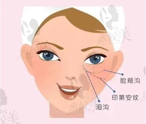 李韵芳医生怎么预约挂号？