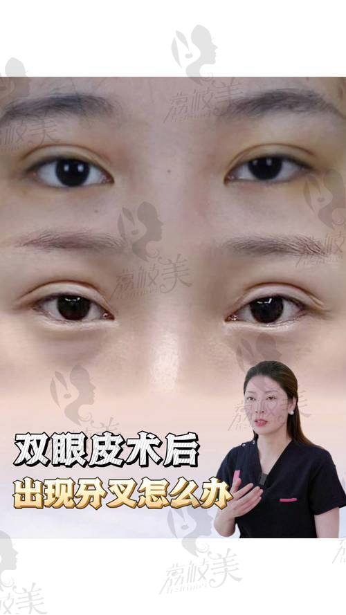 5800 - 16800 元双眼皮：邯郸美弧美润的技术优势大揭秘