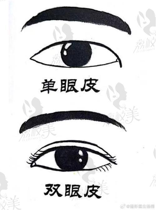 5800 - 16800 元双眼皮真人实例：邯郸美弧美润的美丽奇迹