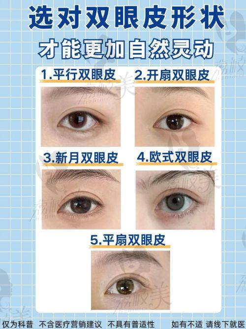 宋蔚医生做双眼皮怎么样？独家无痕翘睫技术，仅需3800元起，打造自然灵动美眼！