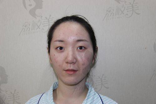 如何预约深圳吕瑛医生？