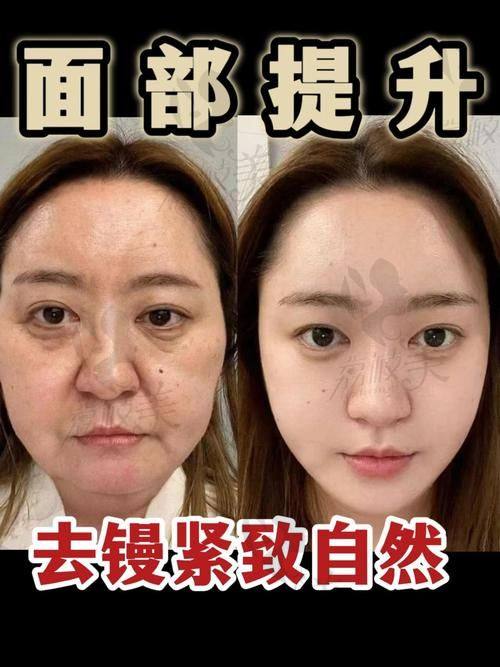 卢元刚在哪家医院任职？答案是成都素美医美，擅长项目多，技术优势超亮眼！