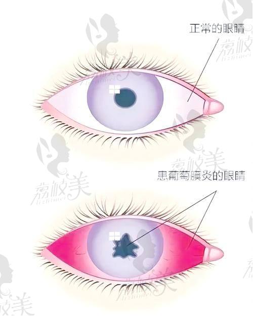 青光眼项目价格公开管理方案