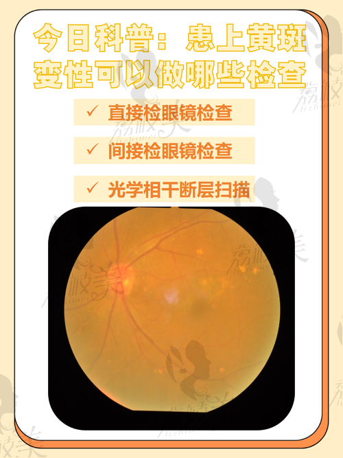 干眼治疗项目及价格详解