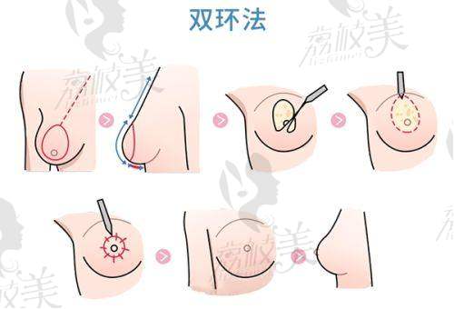 罗姗医生怎么预约挂号?