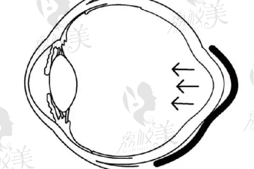 上海缩阴手术价格说明
