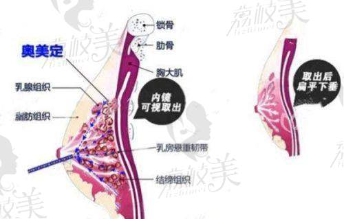 北京异物取出干净的