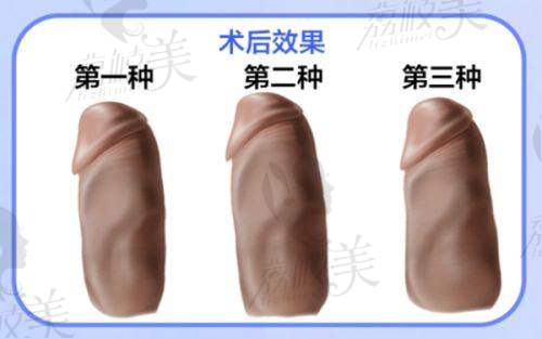 罗姗医生口碑怎么样?