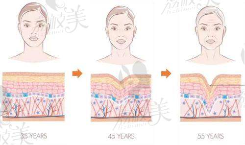 台州艺星医疗美容医院杨芒利吸脂8000元起：医生特色