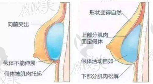 台州艺星医疗美容医院杨芒利吸脂8000元起：患者口碑