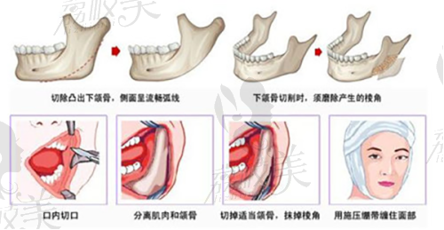 上海美莱整形医院——上海值得信赖的缩阴手术医院