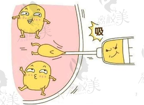 陈超医生技术特点：