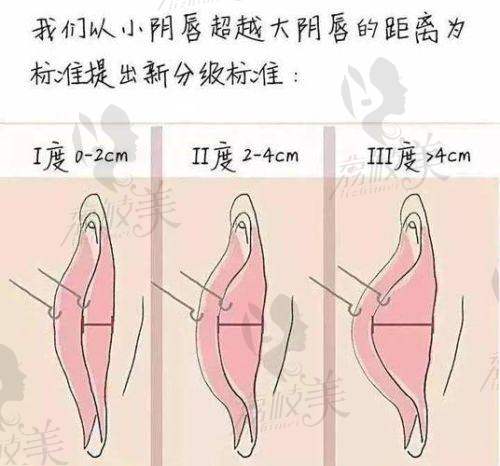 新疆石河子希望医院（私密科）特色项目：