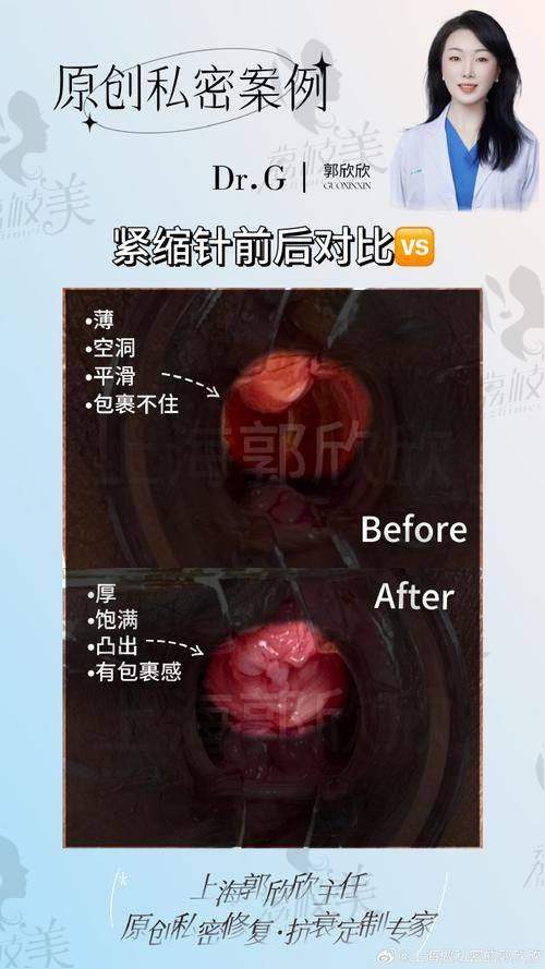 新疆石河子希望医院（私密科）价格表：