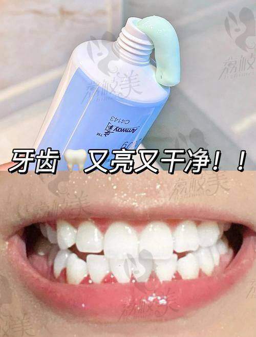沈阳德立联合郑淳奎做抛光喷砂洗牙价格优势：278 元起的高性价比洁牙