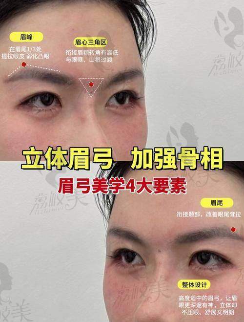 南昌阅美医疗美容吕建华眉弓填充13800元起,打造立体深邃眉眼效果