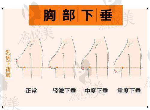 杭州艺星整形价格总结揭秘